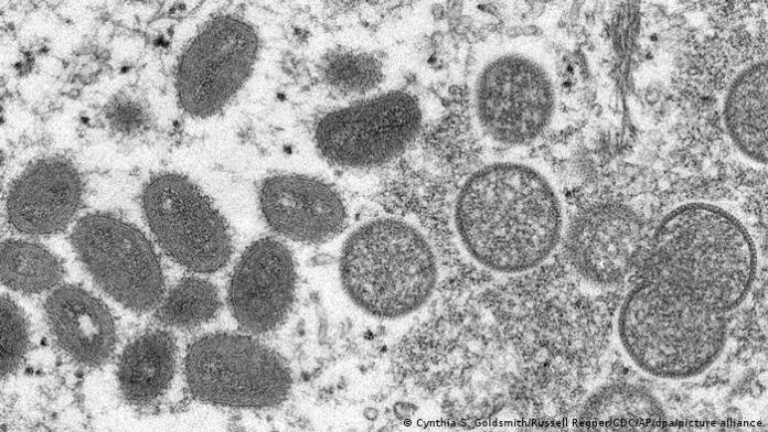 Varíola dos macacos: brasileiro passa bem e tem poucos sintomas, diz clínica alemã